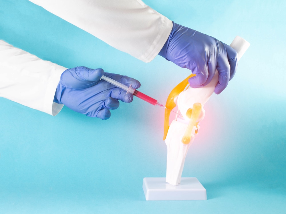 Injeksjon av blodplasma i kne